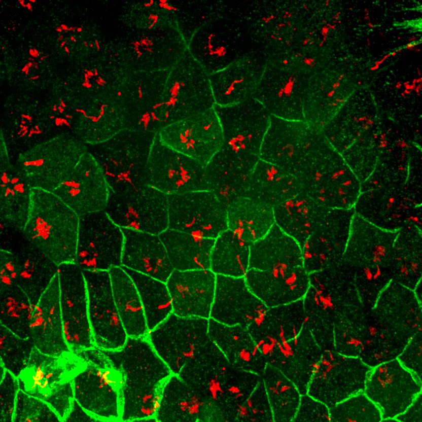 Cilia (red) in mouse brain cells